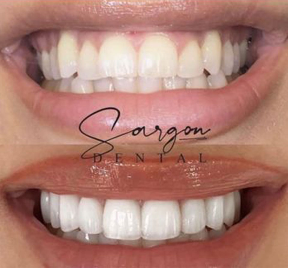 Patient transformation